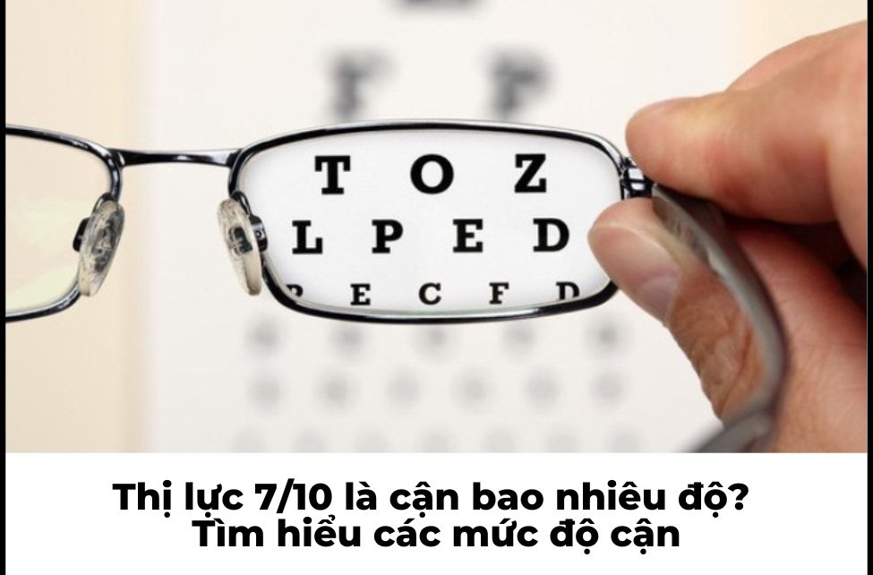 Thị lực 7/10 là cận bao nhiêu độ